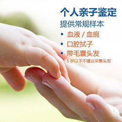 湖北个人亲子鉴定需要怎么做【鉴定咨询】